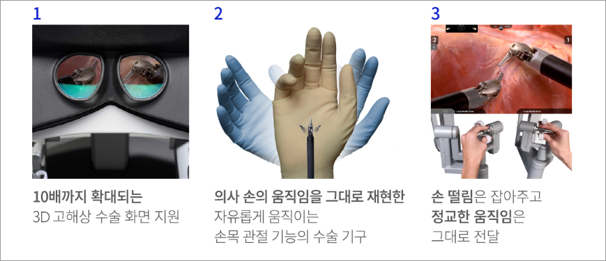 로봇수술의 기술적 이점